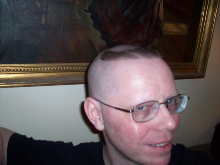 The Biggest Contribution Of Horseshoe Haircut To Humanity horseshoe