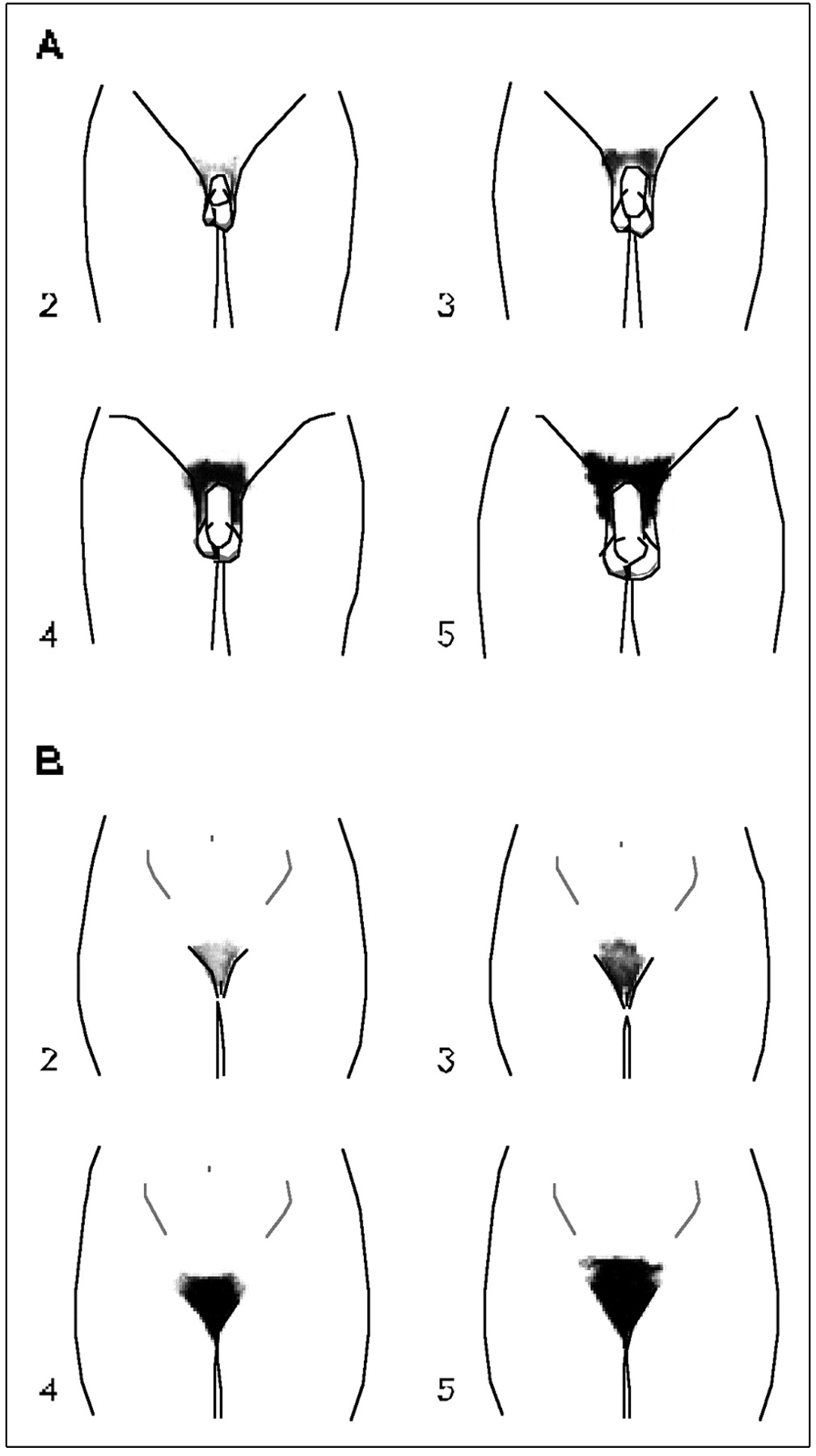 Pubic hairstyles men